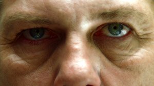 Dr. House Epizóda 1