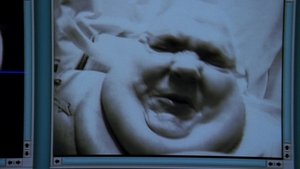 Dr. House Epizóda 6