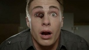 Teen Wolf Epizóda 7